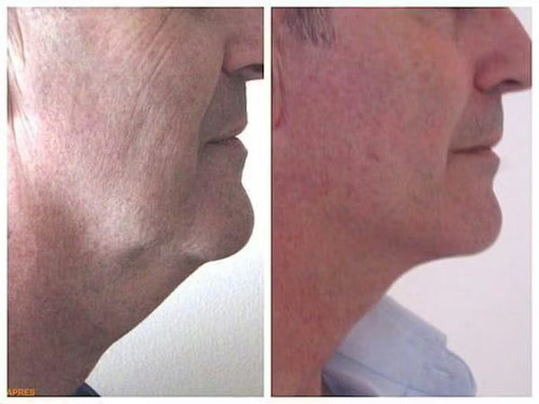 Des résultats visible