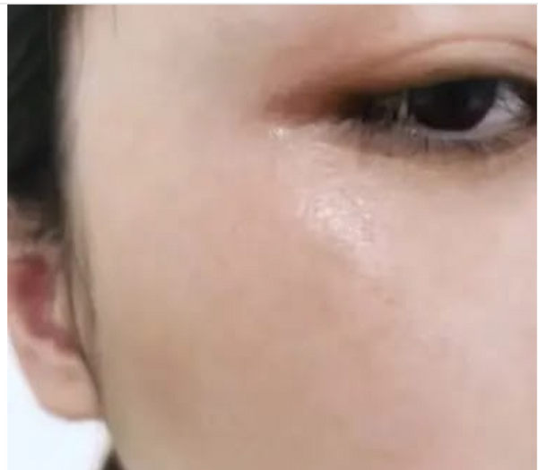 Enfin j'ai retrouvé confiance en ma peau ! ✨