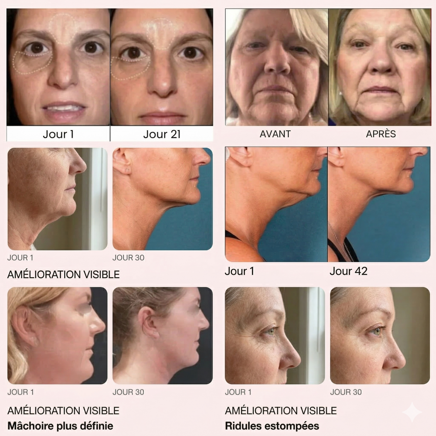 DermaSculpt,  Lifting Visage & Cou