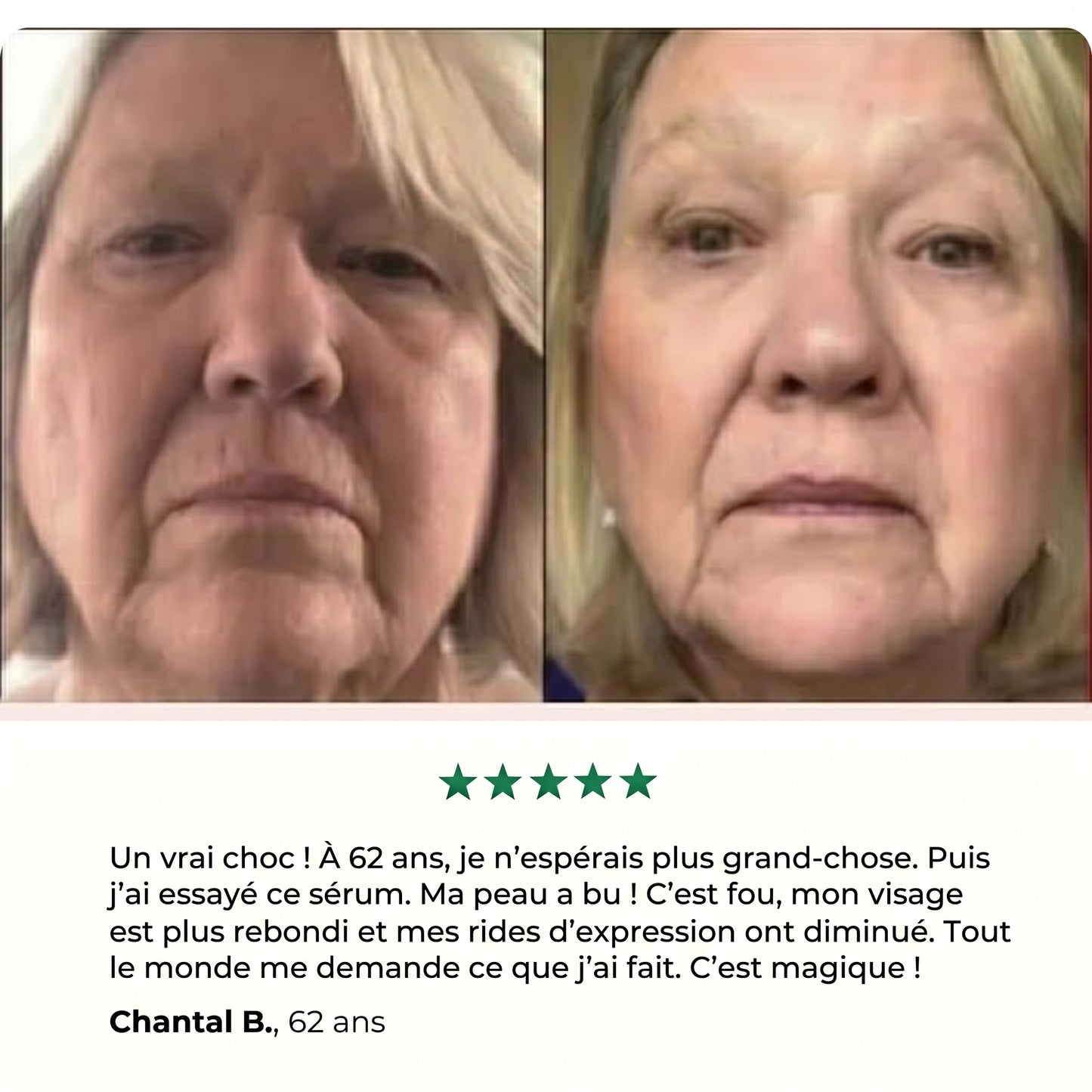 DermaSculpt,  Lifting Visage & Cou