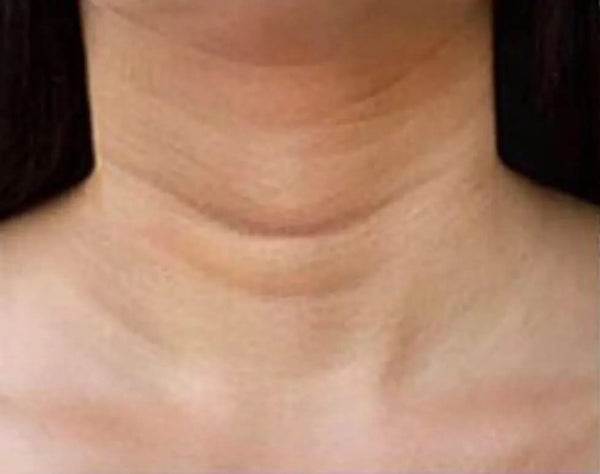 Mes rides du cou ont quasiment disparu ! ✨