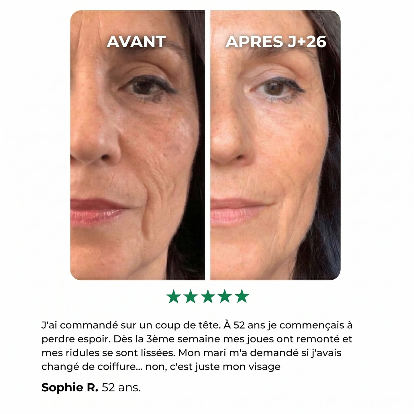 DermaSculpt,  Lifting Visage & Cou